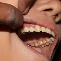 Dental Care